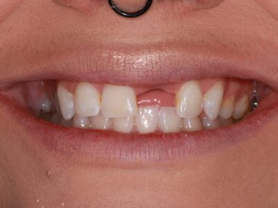 Before - Brunswick Dental Practice