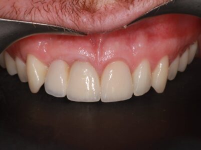 After - Brunswick Dental Practice