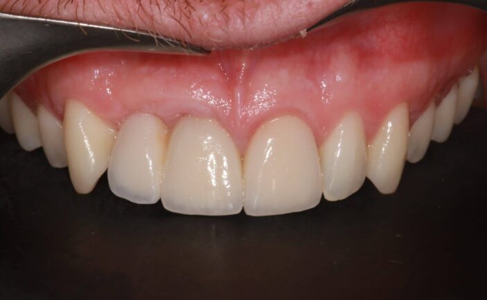 After - Brunswick Dental Practice