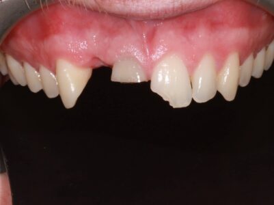 Before - Brunswick Dental Practice