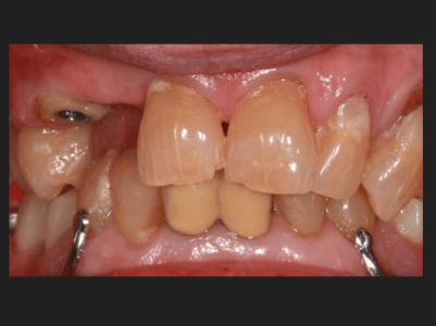 Before - Brunswick Dental Practice