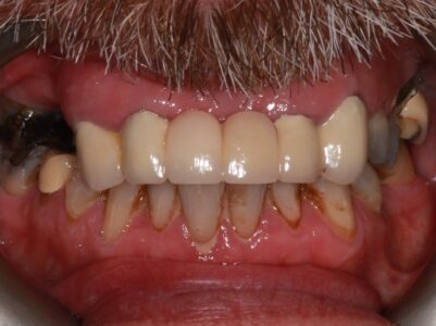 Before -Brunswick Dental Practice