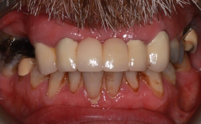 Before - Brunswick Dental Practice