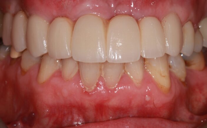 After - Brunswick Dental Practice