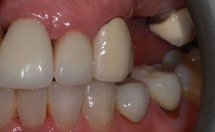 After - Brunswick Dental Practice