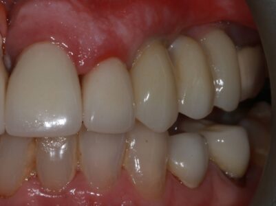 Before - Brunswick Dental Practice