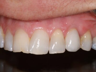 After - Brunswick Dental Practice