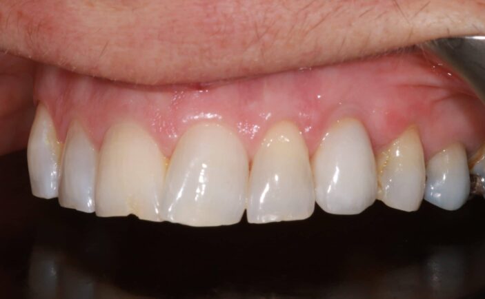 After - Brunswick Dental Practice