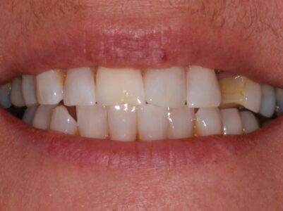 Before -Brunswick Dental Practice