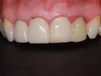 Before - Brunswick Dental Practice