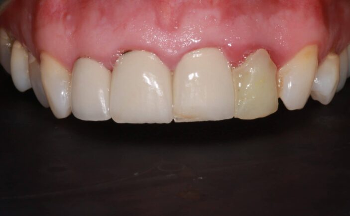 Before - Brunswick Dental Practice