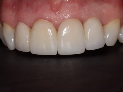 After - Brunswick Dental Practice