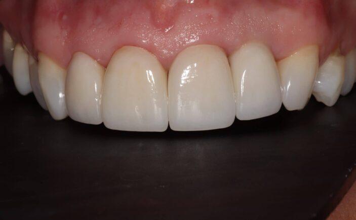 After - Brunswick Dental Practice