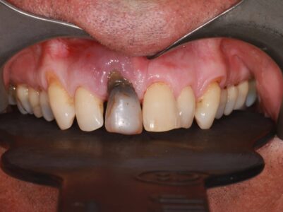 Before -Brunswick Dental Practice