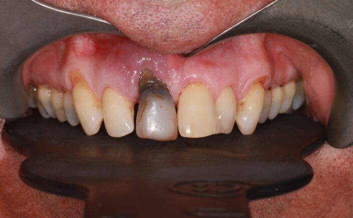 Before - Brunswick Dental Practice