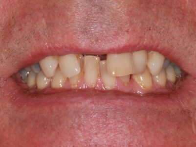 After - Brunswick Dental Practice