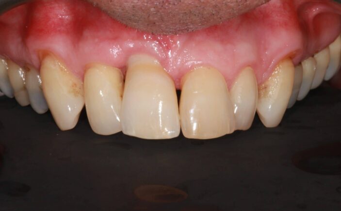 After - Brunswick Dental Practice