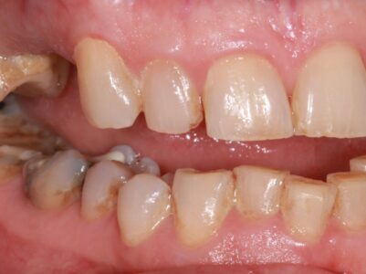 Before -Brunswick Dental Practice