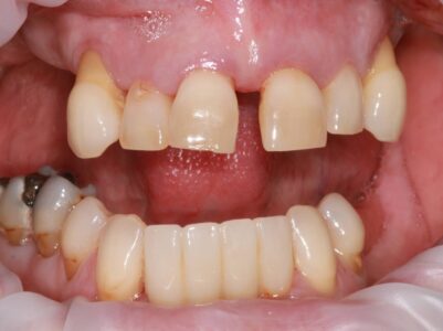 Before -Brunswick Dental Practice