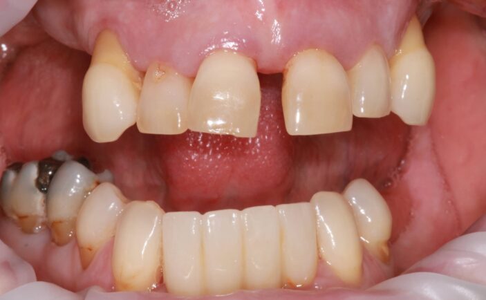 Before - Brunswick Dental Practice