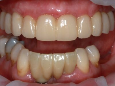 After - Brunswick Dental Practice