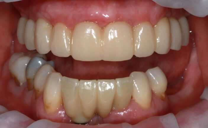 After - Brunswick Dental Practice