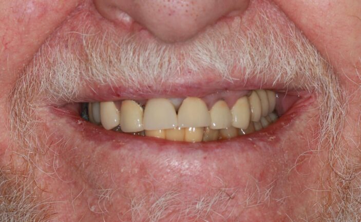 After - Brunswick Dental Practice