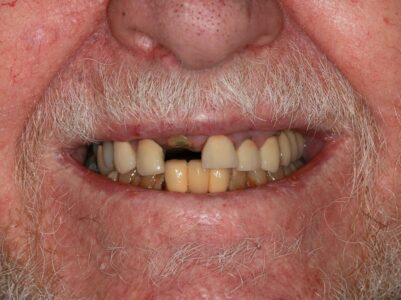 Before -Brunswick Dental Practice