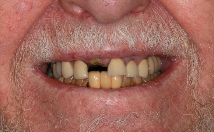 Before - Brunswick Dental Practice