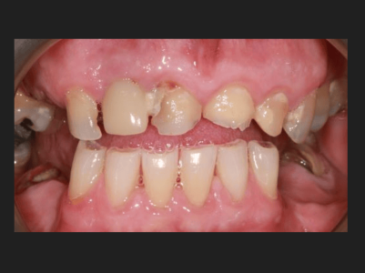 Before -Brunswick Dental Practice