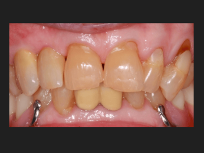 After - Brunswick Dental Practice