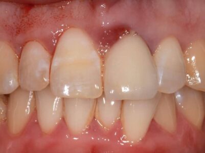 Before - Brunswick Dental Practice