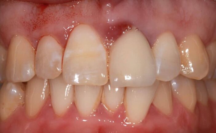 Before - Brunswick Dental Practice