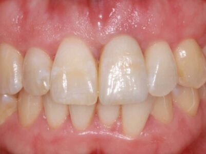 After - Brunswick Dental Practice