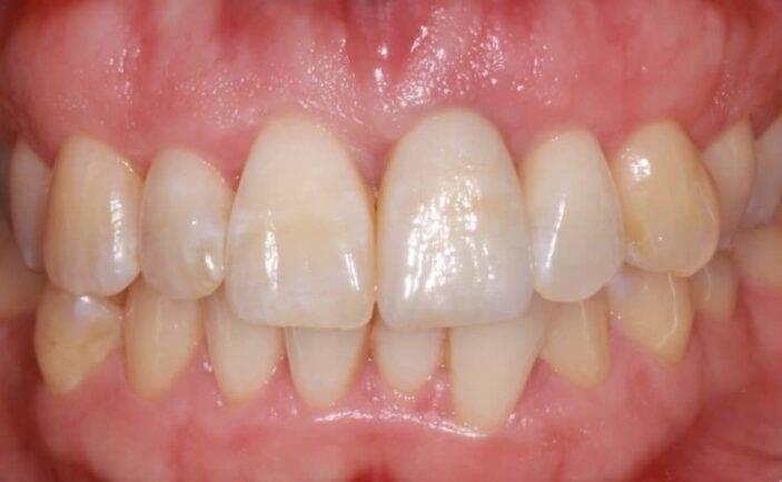 After - Brunswick Dental Practice