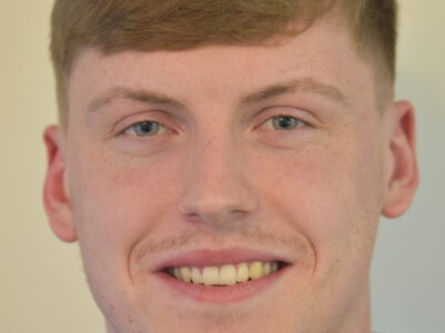 After - Brunswick Dental Practice